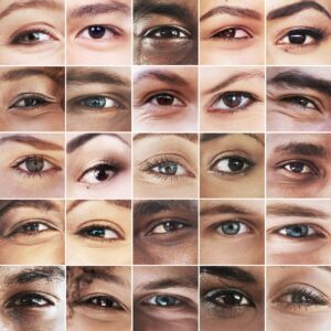 Age-related macular degeneration