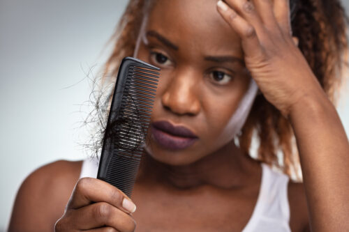 Thriving in Menopause Season 12, Ep 05: Managing menopausal hair loss