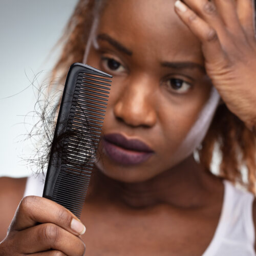 Thriving in Menopause Season 12, Ep 05: Managing menopausal hair loss