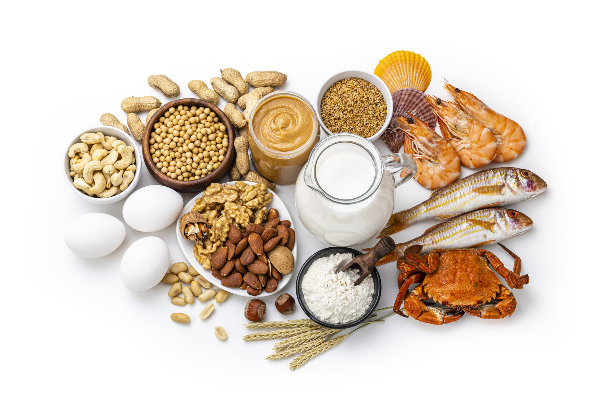 How to manage common food allergies safely